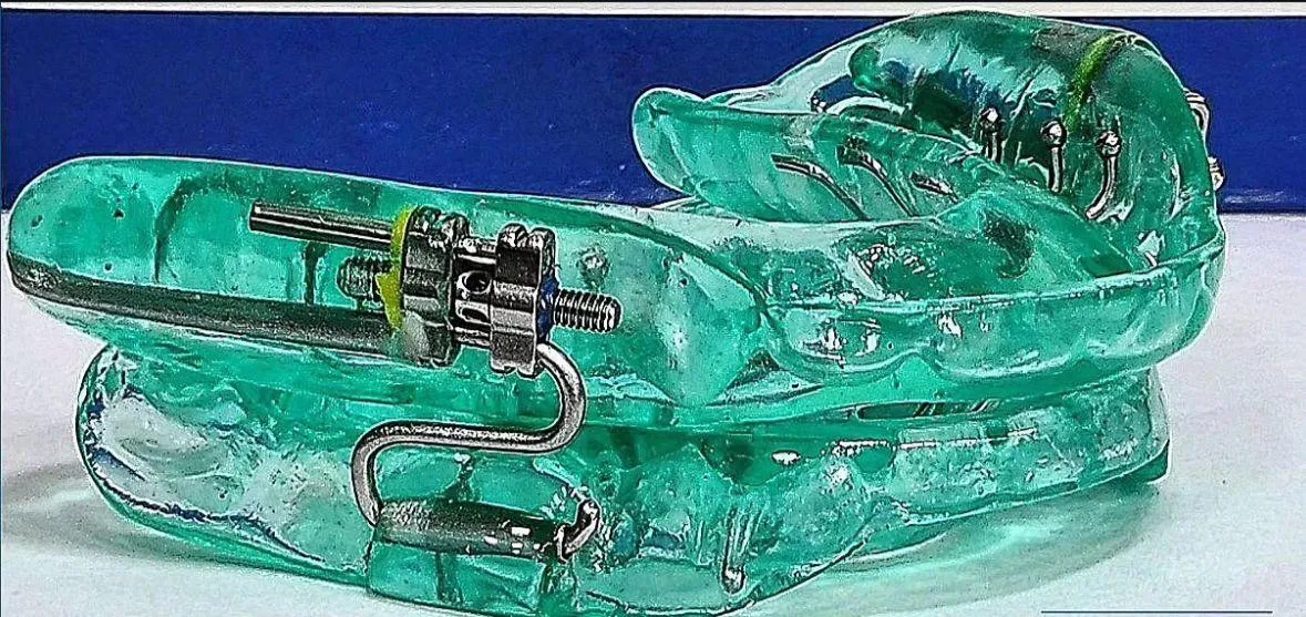 Dispositivo intraoral verde para tratamento de ronco